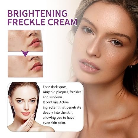 Spot Fading Urea Cream – Dark Spot Removal, Whitening & Freckle Reduction Cream