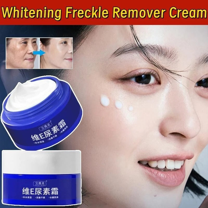 Spot Fading Urea Cream – Dark Spot Removal, Whitening & Freckle Reduction Cream